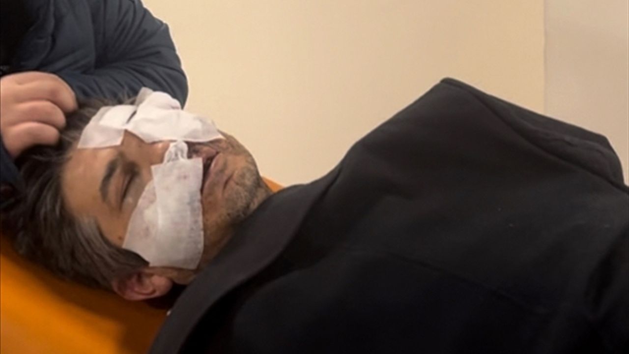 Sivas Ziraat Odası Genel Sekreteri Bekir Yıldız, yumruklu saldırıda yaralandı